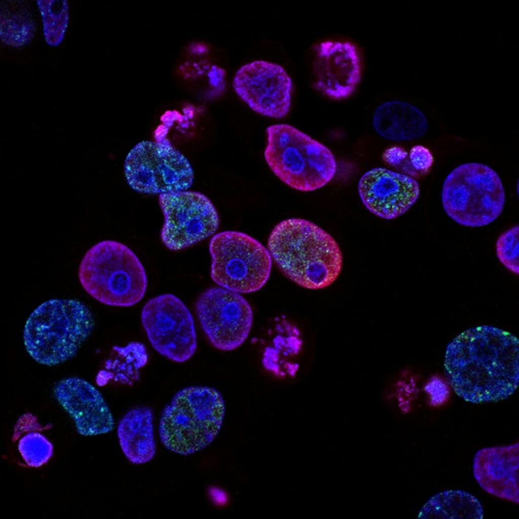 Fluorescence microscopy image showing cell nuclei stained in blue, magenta, and green